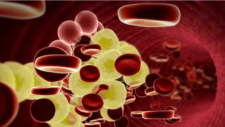 Phác đồ điều trị rối loạn lipid máu kết hợp điều trị tại nhà