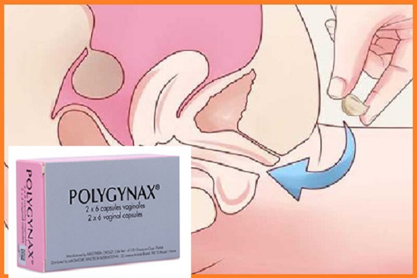 Hướng dẫn các bước đặt thuốc polygynax không bị chảy ra ngoài