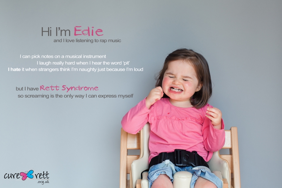 Hội chứng Rett thường gặp ở bé gái