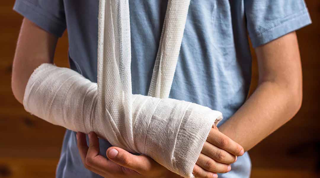 Bài tập phục hồi chức năng gãy xương cánh tay an toàn
