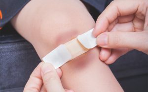 Vết bỏng bị nhiễm trùng có dấu hiệu gì? Cách xử lý ra sao?