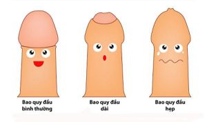 Trẻ bị hẹp bao quy đầu có nguy hiểm không? Dấu hiệu và cách chữa bệnh như thế nào?