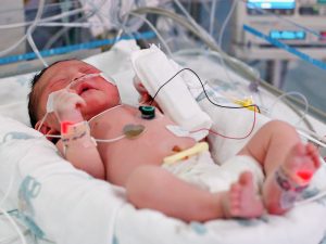 Nên chăm sóc trẻ bị nhiễm trùng máu như thế nào?