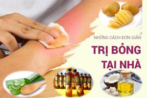 Những cách trị bỏng giảm đau rát hiệu quả ngay tại nhà