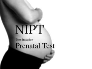 Xét nghiệm nipt là gì? Những điều cần biết về xét nghiệm Nipt
