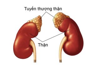 Suy thượng thận có nguy hiểm không? Có chữa khỏi không?