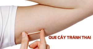 Que cấy tránh thai là gì? Que cấy tránh thai có an toàn không?