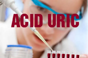 Chỉ số acid uric cao cho biết điều gì? Chế độ ăn uống với người bị axit uric cao