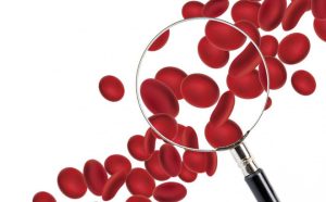 Nhóm máu AB có hiếm không? Có cho nhận được không?