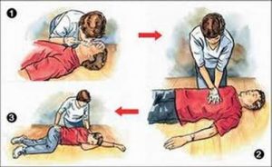 Phác đồ cấp cứu ngừng tuần hoàn thực hiện như thế nào?