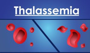 Bệnh Thalassemia là gì? Phương pháp điều trị bệnh như thế nào?