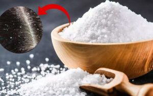 Bí quyết trị gàu tại nhà đơn giản và hiệu quả bất ngờ