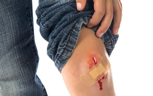 vết thương bị nhiễm trùng1