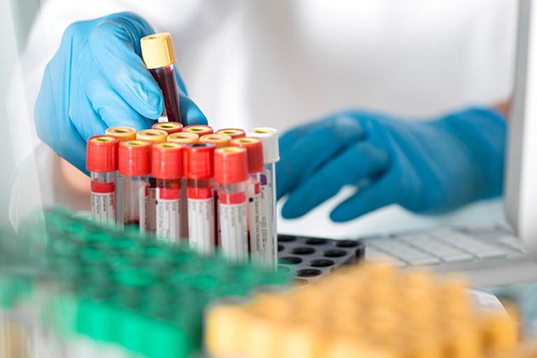 Không chủ quan khi chỉ số ALT tăng cao