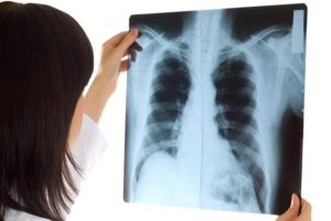 Kỹ thuật viên X Quang có nhiệm vụ gì? Tầm quan trọng với hệ thống y tế hiện nay