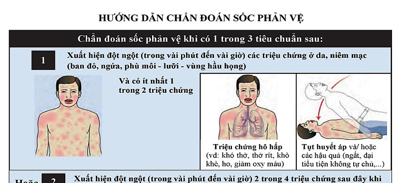 Chẩn đoán sốc phản vệ ở bệnh nhân