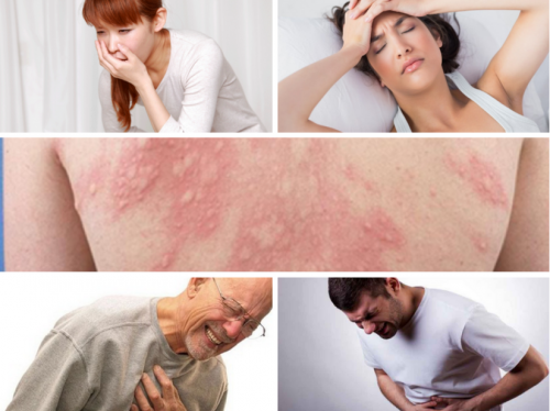 Triệu chứng sốc phản vệ nguy hiểm đến tính mạng