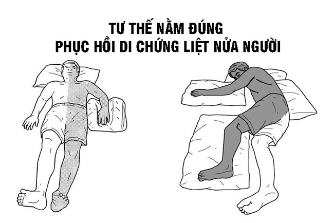 Tư thế nằm cho bệnh nh&acirc;n liệt nửa người