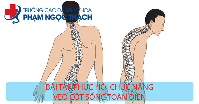 Học Phục Hồi Chức Năng vẹo cột sống ở đ&acirc;u uy t&iacute;n?