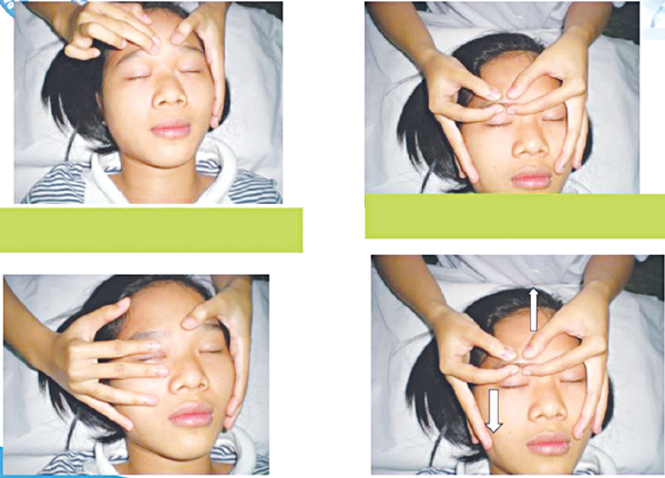 B&agrave;i tập phục hồi chức năng liệt 7 ngoại bi&ecirc;n an to&agrave;n v&agrave; hiệu quả