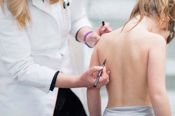 Cong vẹo cột sống ảnh hưởng đến sinh hoạt, cuộc sống bệnh nh&acirc;n 