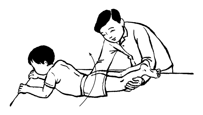 C&aacute;c b&agrave;i tập Phục hồi chức năng cong vẹo cột sống 