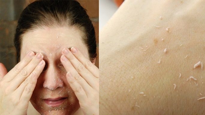 Thường xuy&ecirc;n tẩy da chết tr&ecirc;n mặt