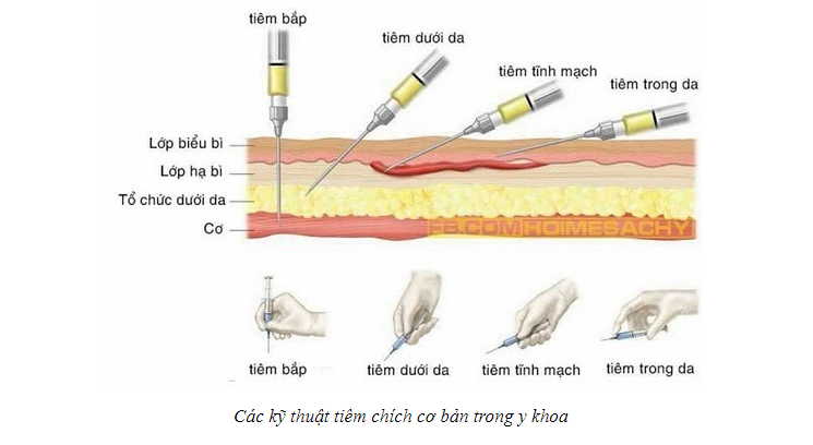 Tiêm bắp là gì?