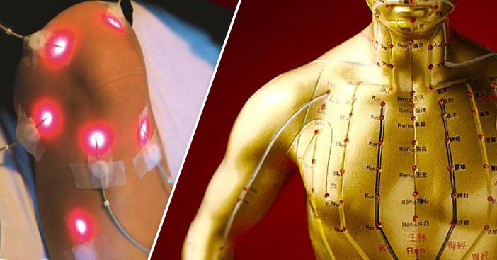 Chải th&ocirc;ng kinh lạc l&agrave; g&igrave;?