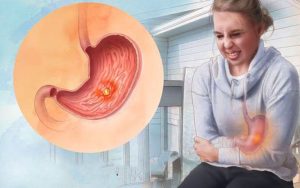 Lập kế hoạch chăm sóc bệnh nhân thủng dạ dày an toàn