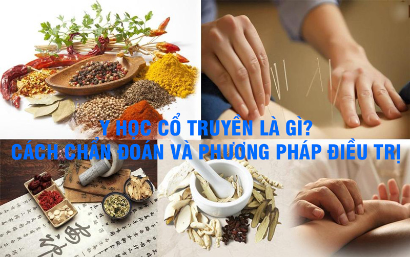 Y học cổ truyền l&agrave; g&igrave;?