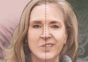 Liệt dây thần kinh số 7 có chữa khỏi không?