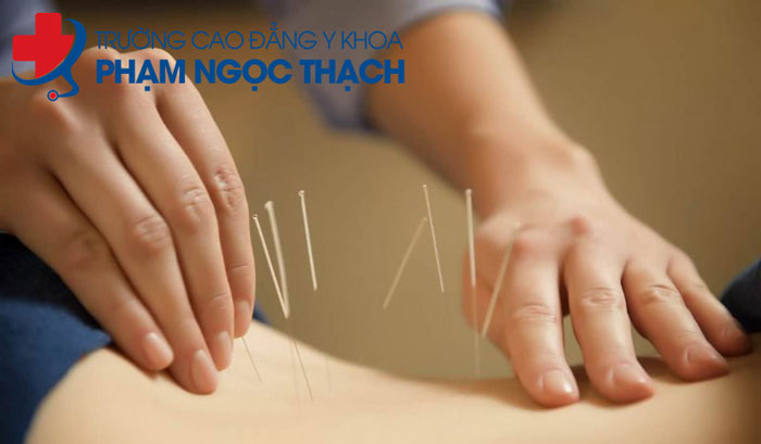 Học phục hồi chức năng sau tai biến