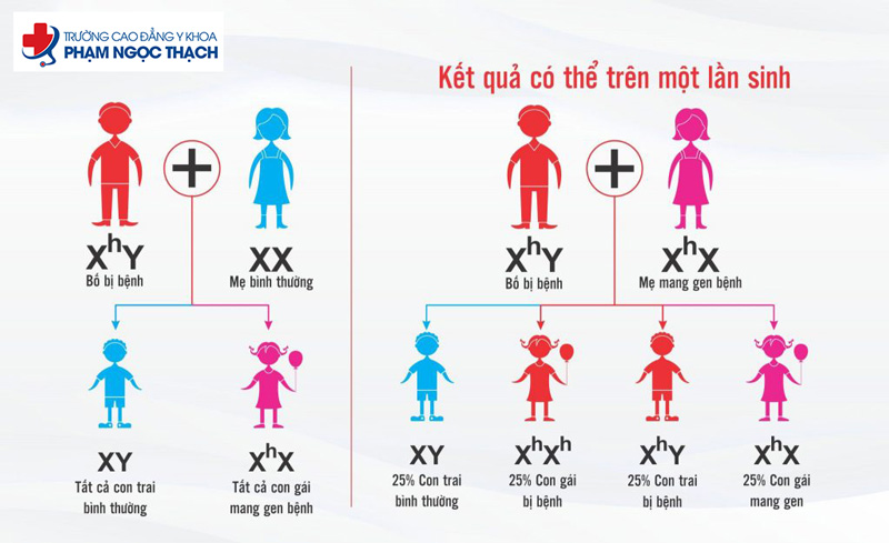 Nguy&ecirc;n nh&acirc;n g&acirc;y bệnh m&aacute;u kh&oacute; đ&ocirc;ng do di truyền