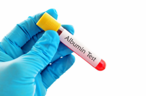 Albumin máu là gì? Công dụng của Albumin máu