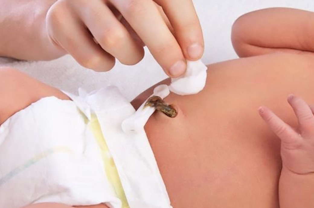 Quy tr&igrave;nh chăm s&oacute;c rốn sơ sinh