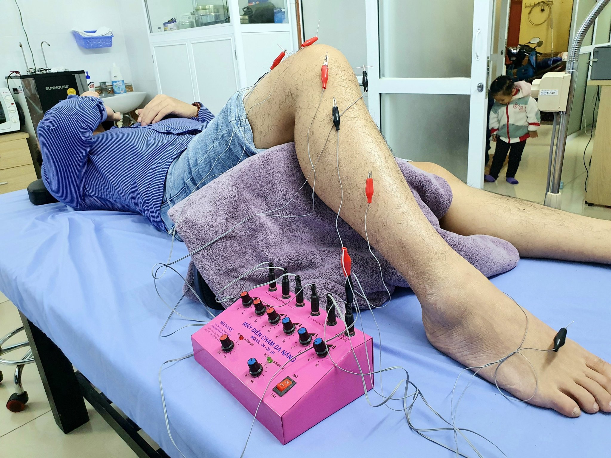 Điện châm hỗ trợ cải thiện vấn đề thần kinh